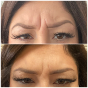 theaesthetox4ticssociety-Beforeandafter2-scaled (1)